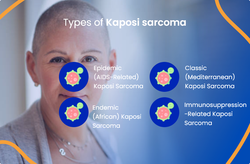 Understanding Kaposi Sarcoma: Causes, Symptoms, And Treatment - Byrd ...